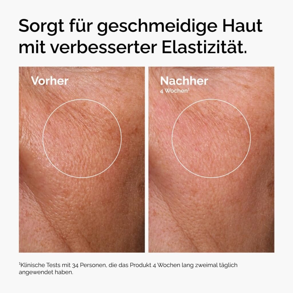 The Ordinary Hyaluronic Acid 2% + B5 (mit Ceramiden) Bewertung