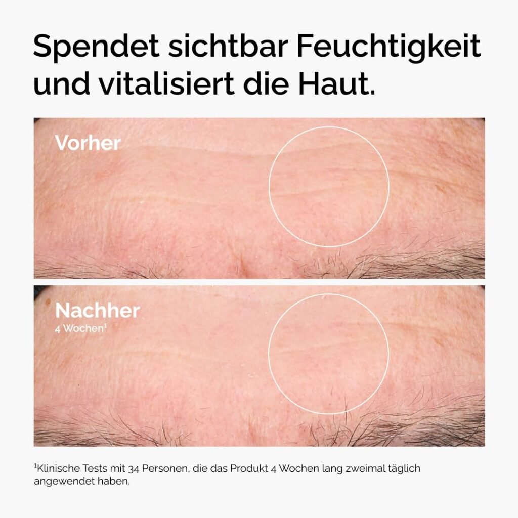 The Ordinary Hyaluronic Acid 2% + B5 (mit Ceramiden) Bewertung
